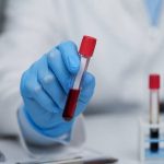 Lipoproteína a: qué es, por qué importa y cómo cuidarla de forma natural