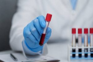 Lipoproteína a: qué es, por qué importa y cómo cuidarla de forma natural