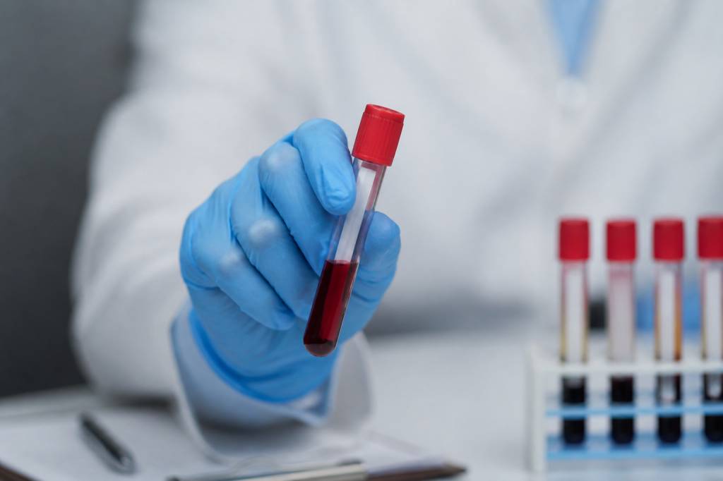 Lipoproteína a: qué es, por qué importa y cómo cuidarla de forma natural